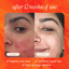 Pineapple & Rosehip Vitamin C Serum - Korvel