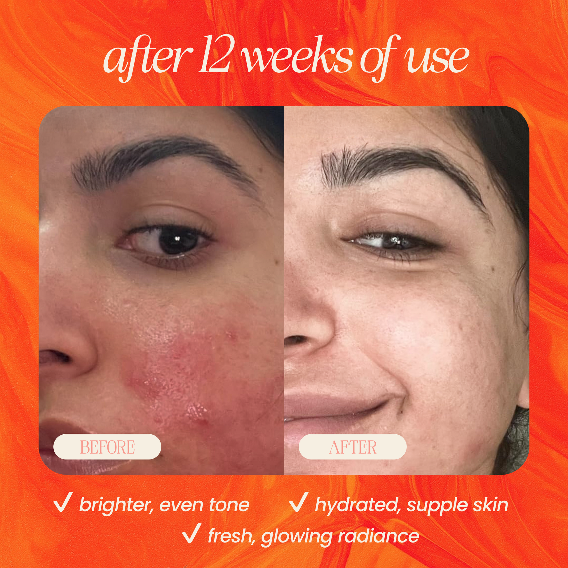 Pineapple & Rosehip Vitamin C Serum - Korvel