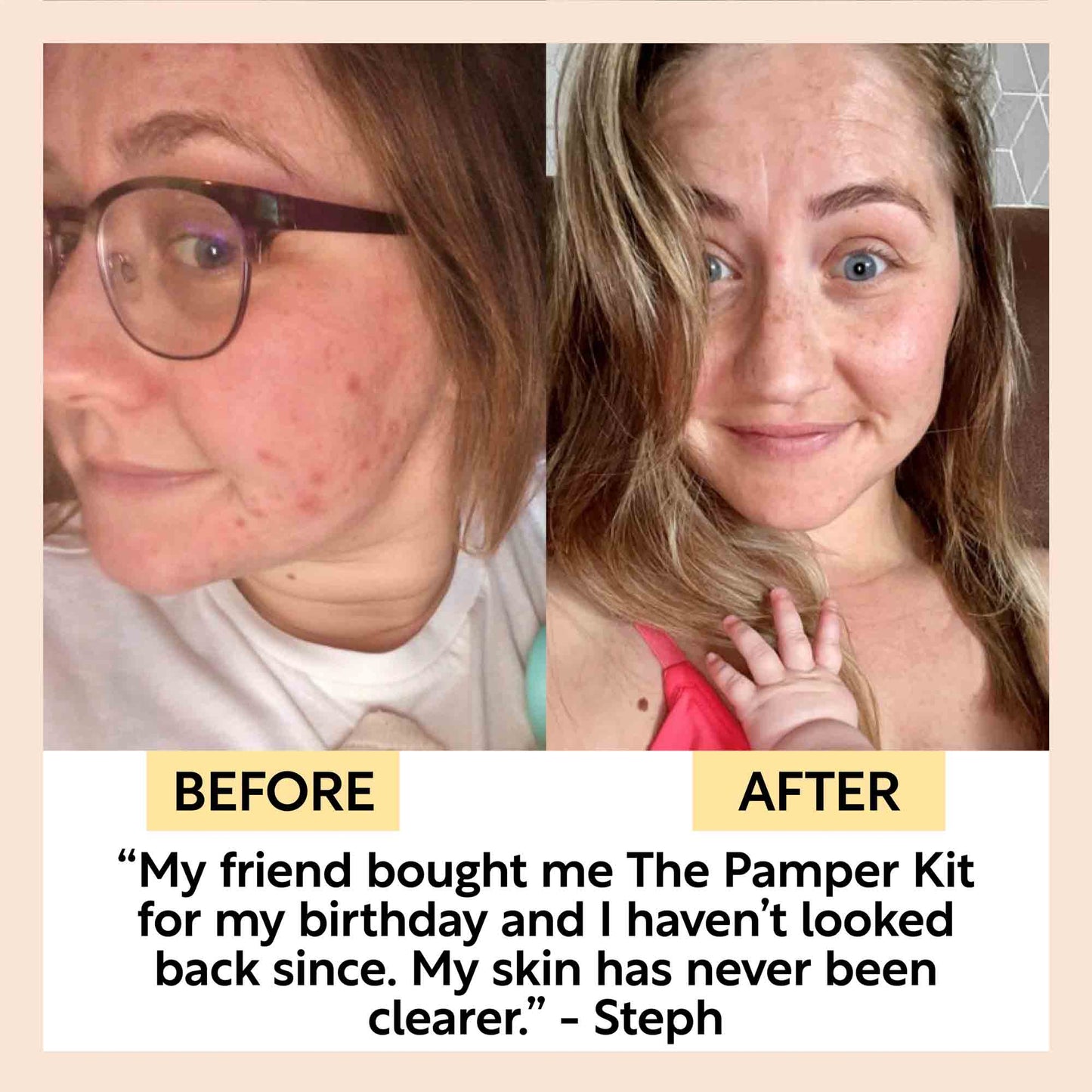 El Kit de Mimos - 17 Muestras Premium