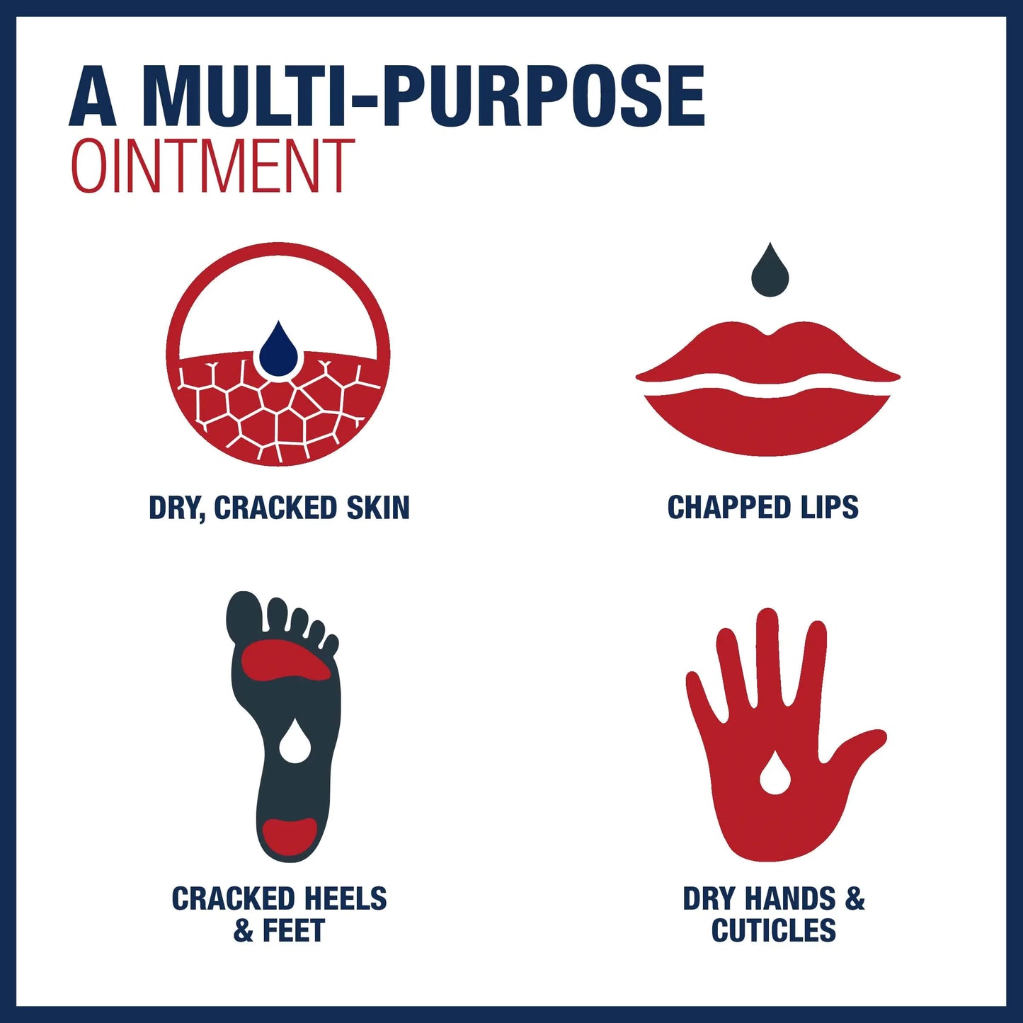 Onguent cicatrisant Aquaphor Thérapie avancée protecteur de la peau - Pack de 3