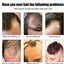 Esencia para el Crecimiento del Cabello Masculino - Revitaliza y Nutre