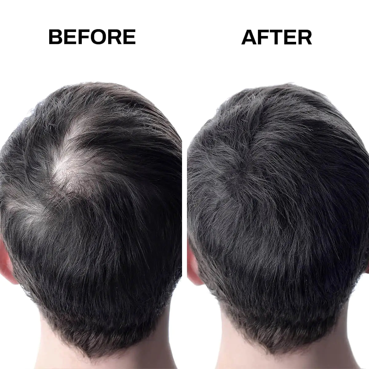 Premium Hair Fibers for Thinning Hair