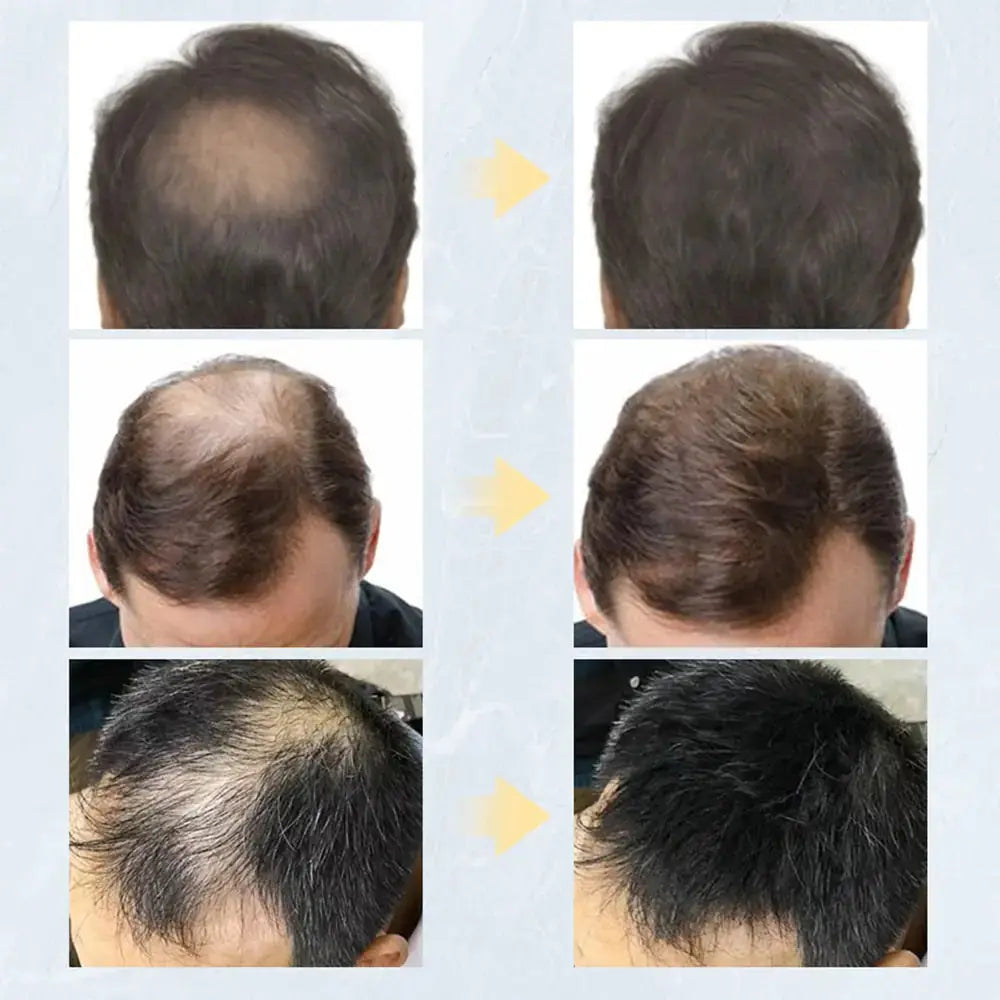 Fibres de kératine pour des cheveux au look plus épais