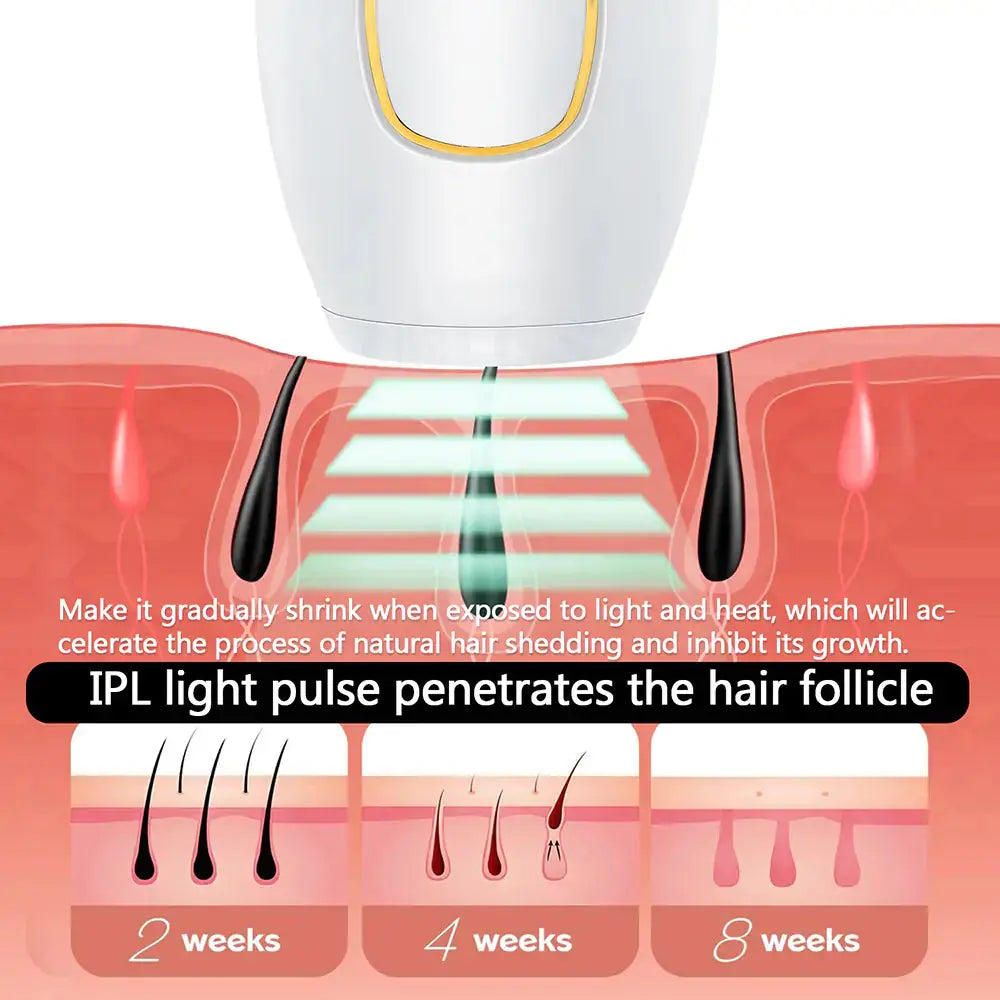 Ensemble de suppression de poils IPL Premium pour un toilettage sans effort