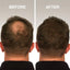 Premium Hair Fibers for Thinning Hair