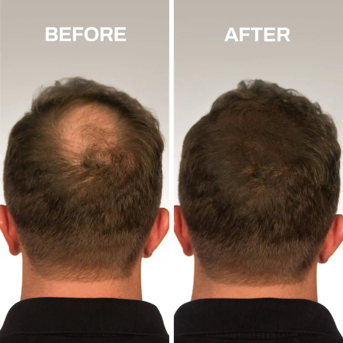 Premium Hair Fibers for Thinning Hair