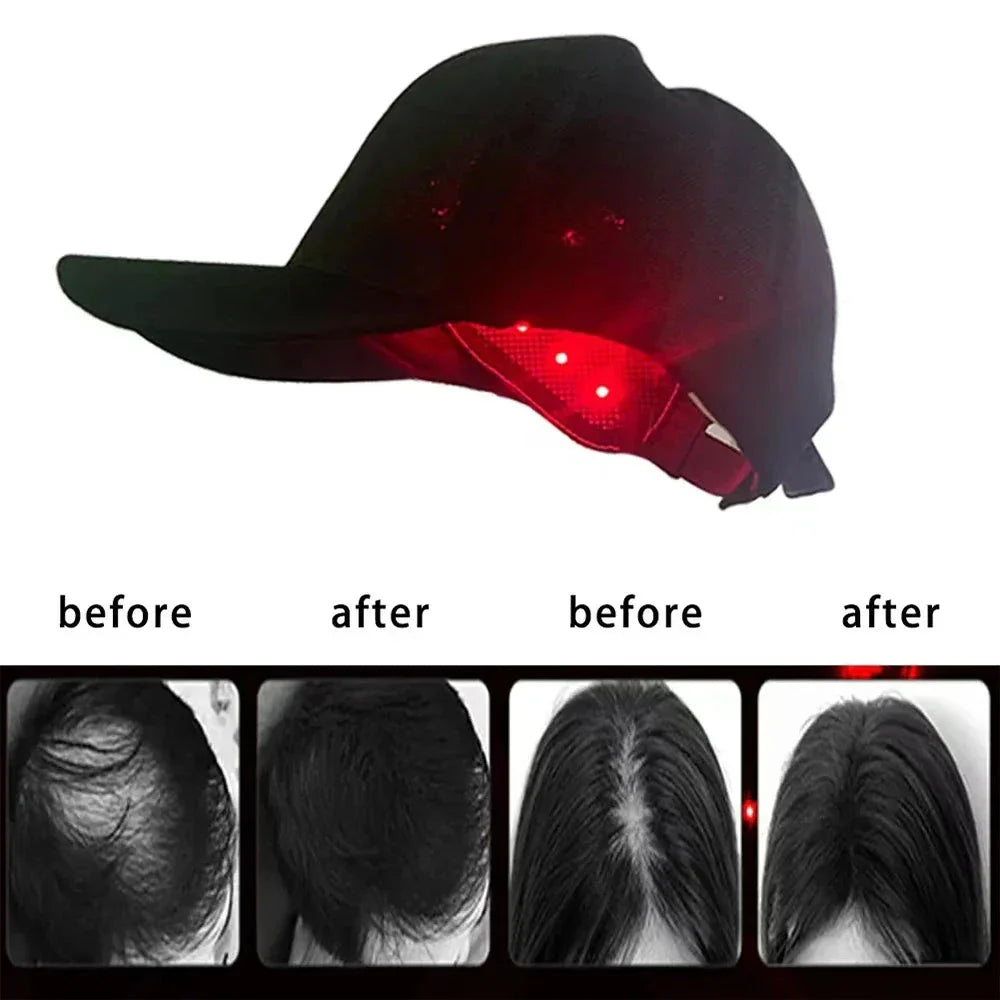 DualBeam HairCap - Korvel