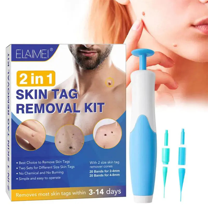 Kit de retrait de verrues premium