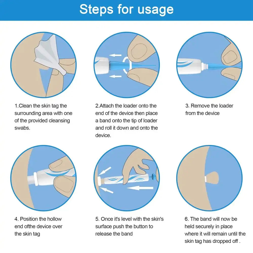 Gentle Skin Tag Removal Kit