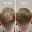 Premium Hair Fibers for Thinning Hair