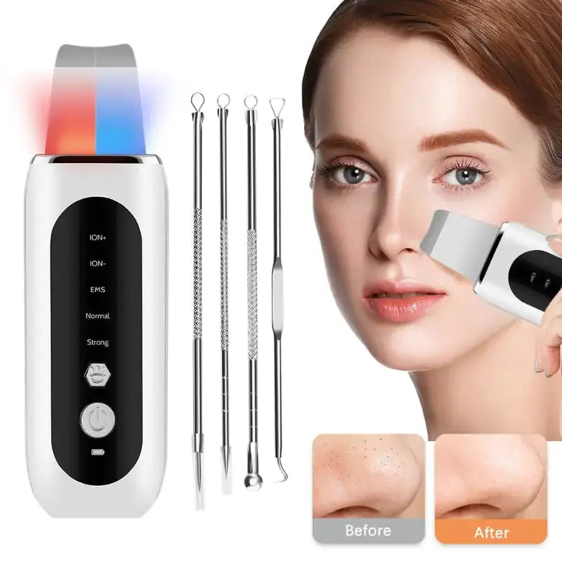Premium Ultrasonic Face Skin Scrubber
