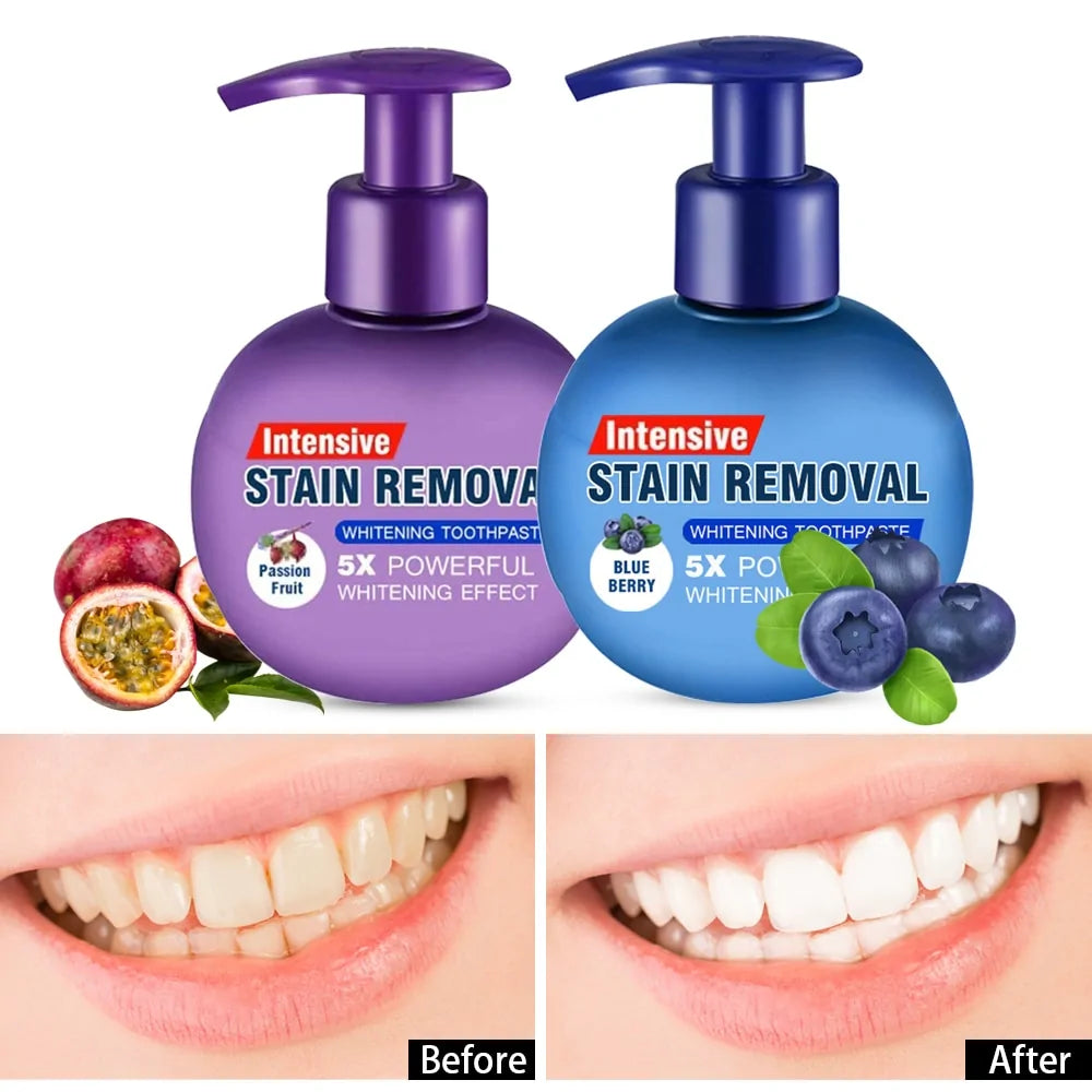 Premium Whitening Toothpaste for Stain Removal