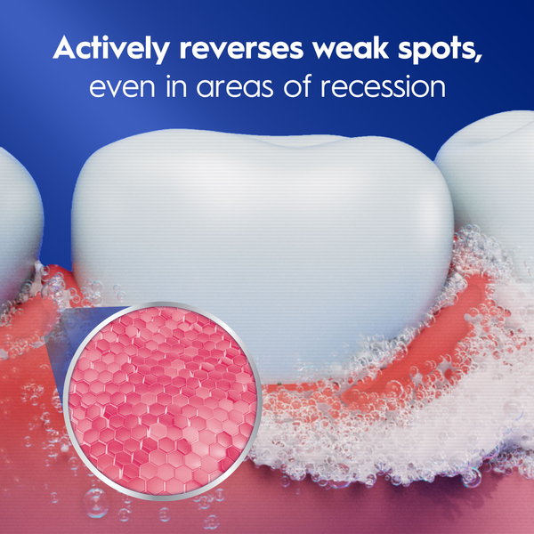 Dentifrice Crest pour la récession gingivale 2,5 oz - Soin doux pour vos gencives