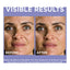 Sérum pour le visage à l'acide hyaluronique L'Oreal Derm Intensives