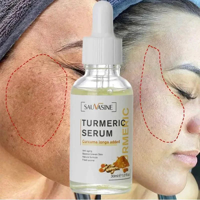 BrightGlow Turmeric Radiance Serum