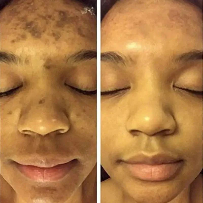 BrightGlow Turmeric Radiance Serum