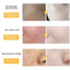 Gold Essence Hyaluronic Serum