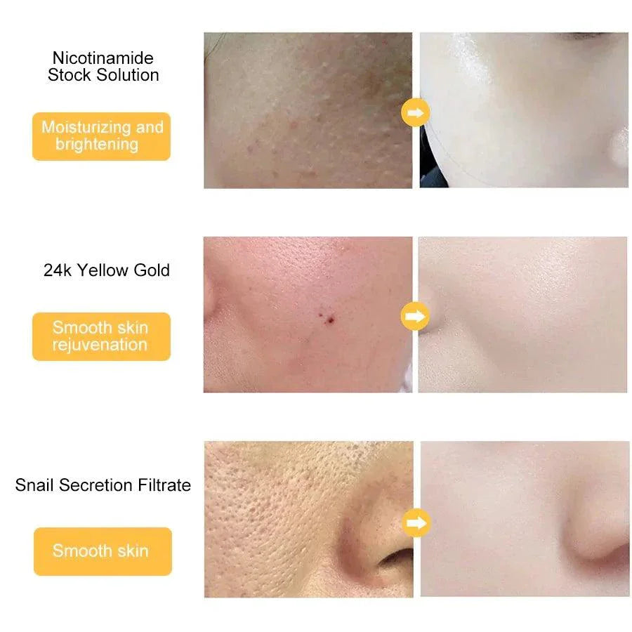 Gold Essence Hyaluronic Serum