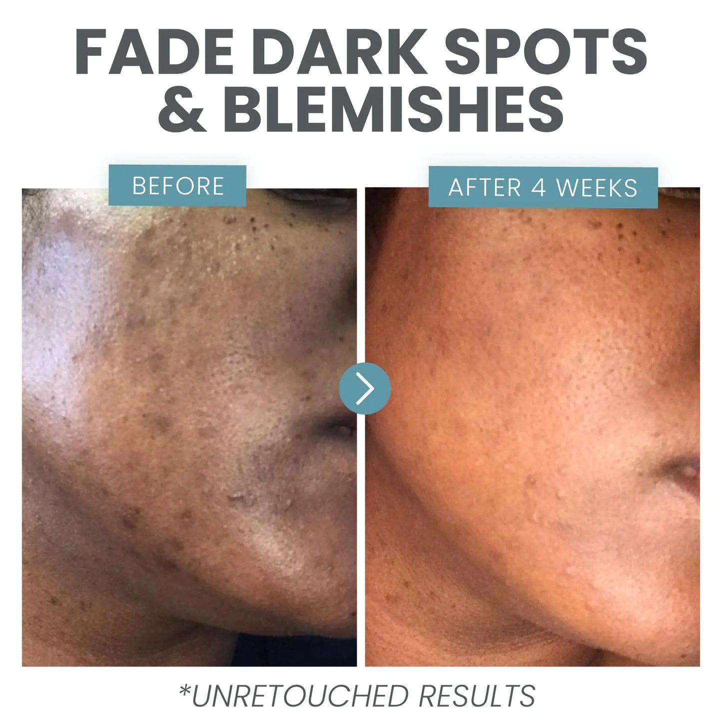 Premium Vitamin C Face Serum with Niacinamide & Hyaluronic Acid