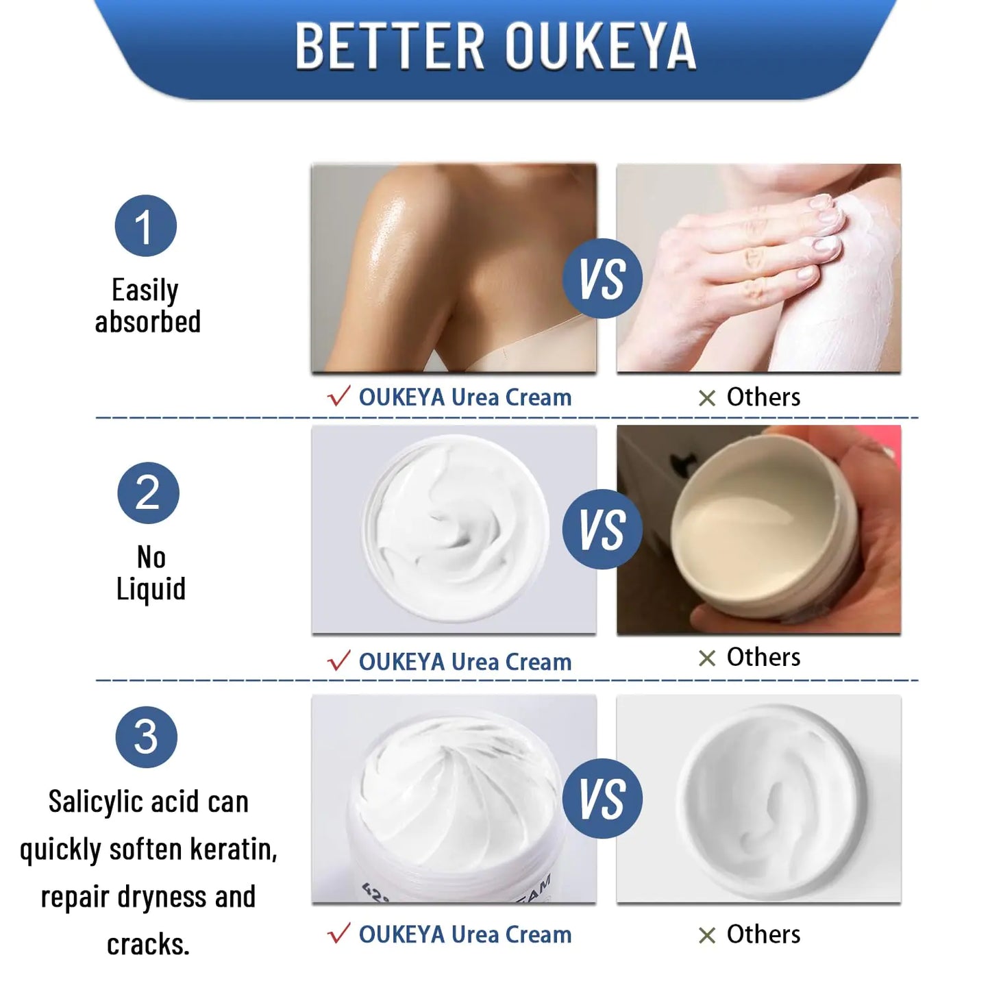 Premium Urea Cream with Salicylic Acid for Foot Care